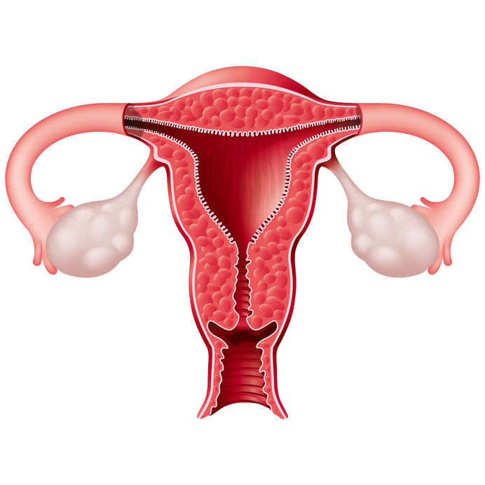ミオイノシトール－多嚢胞卵巣症候群における利用